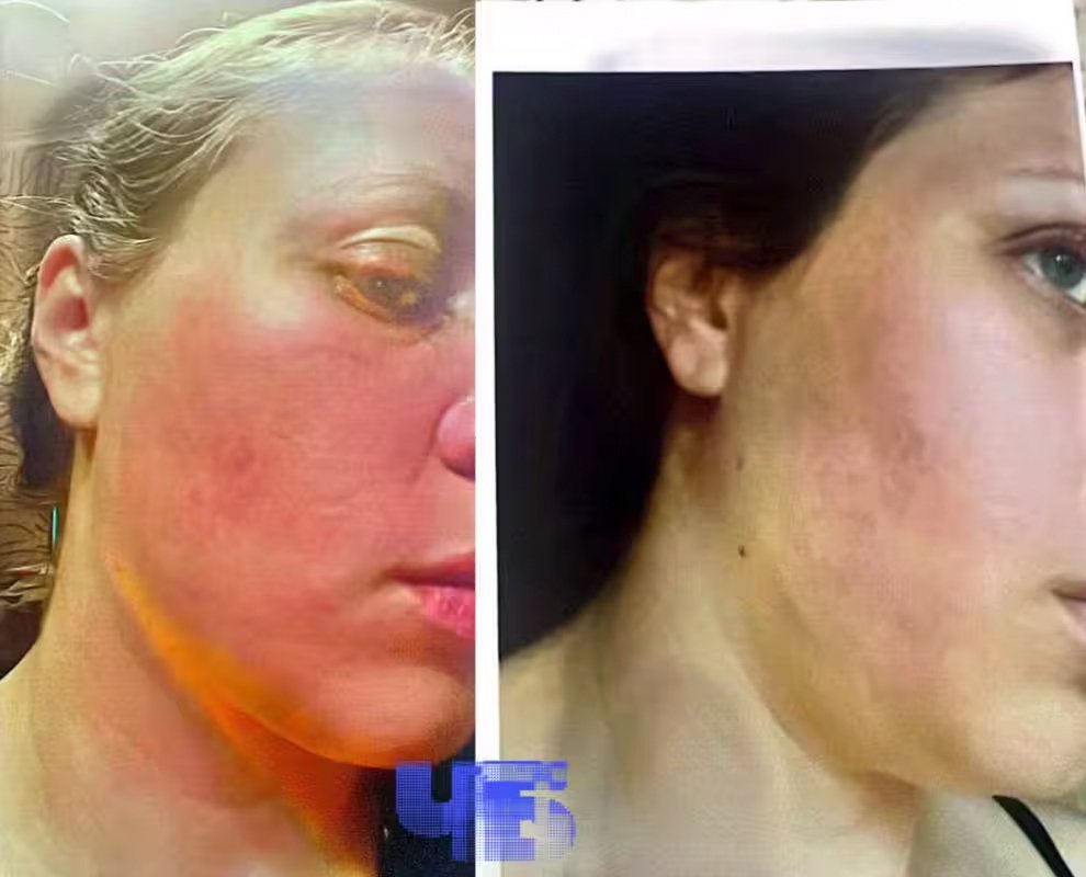 Следы побоев на лице Марины. Фото: « Челябинск Будущего »